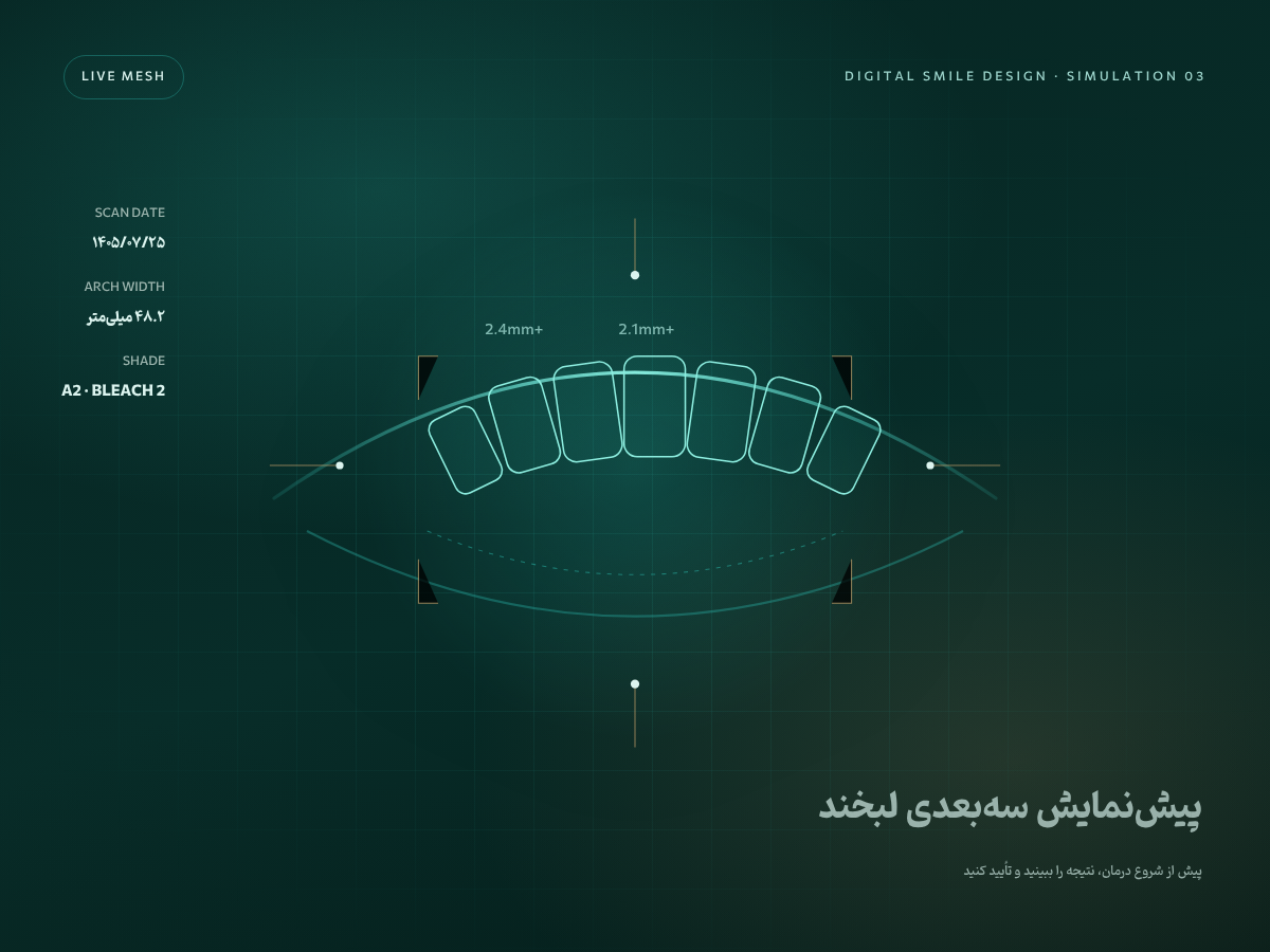 شبیه‌سازی سه‌بعدی لبخند با اسکن داخل‌دهانی